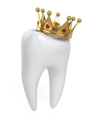 Dental Crown | Dentist In Flint, MI | Mid-Michigan Dental Group